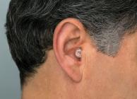 Galerijní obrázek č.3 Ochrana sluchu ETYMOTIC ER20XS-CCC-P